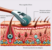 Dermaroller Capillaire